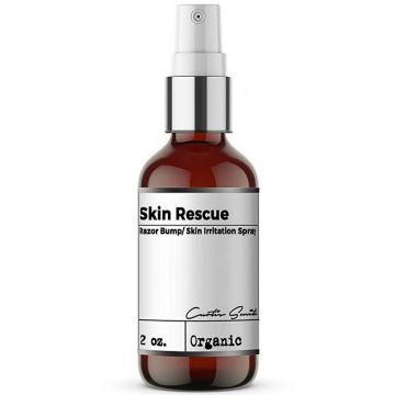 Xotics Skin Rescue Razor Bump / Skin Irritation Spray 2 oz